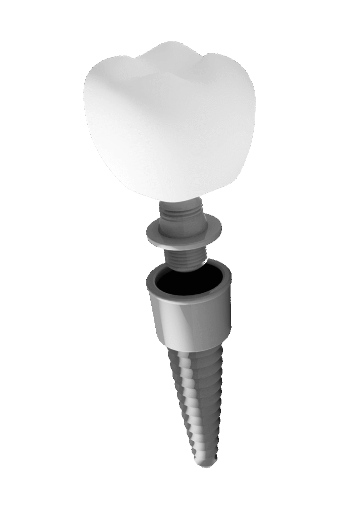 Single Artificial Teeth