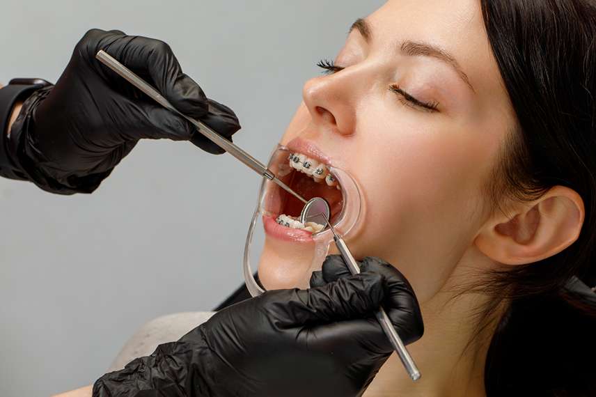 Orthodontic Treatment