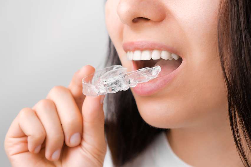 Invisalign at Sharanya Dental